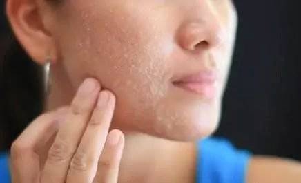 温度|我们脸上的油从哪里来？