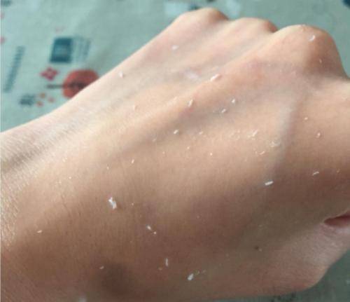 温度|我们脸上的油从哪里来？