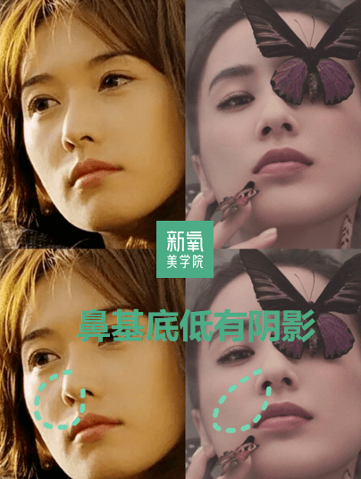 眉骨|给赵露思换了天使大宝贝的眉骨和眼眶骨，这张脸洋气指数飙升120%