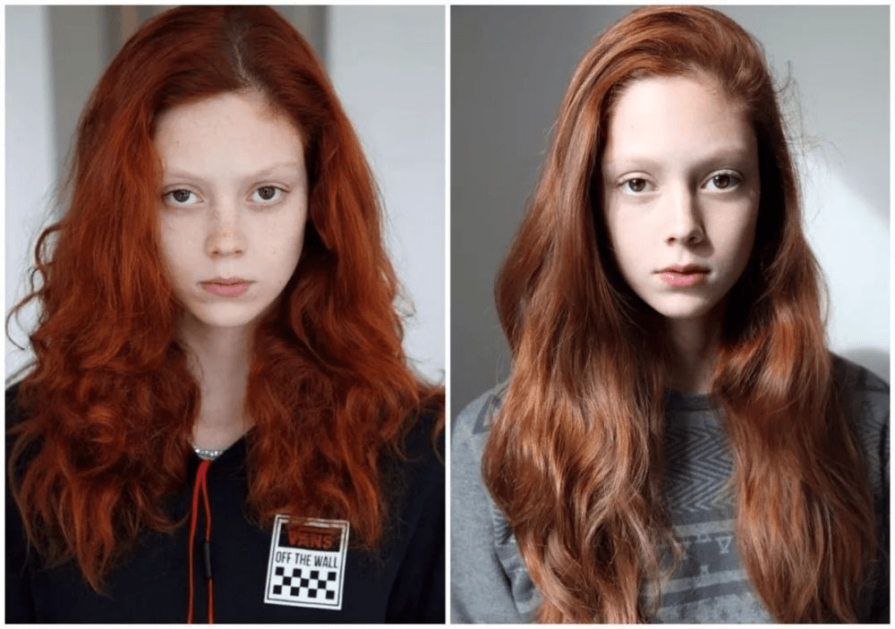 面孔|雀斑模特招热议？变性模特受追捧？到底是谁在为美划定界限？