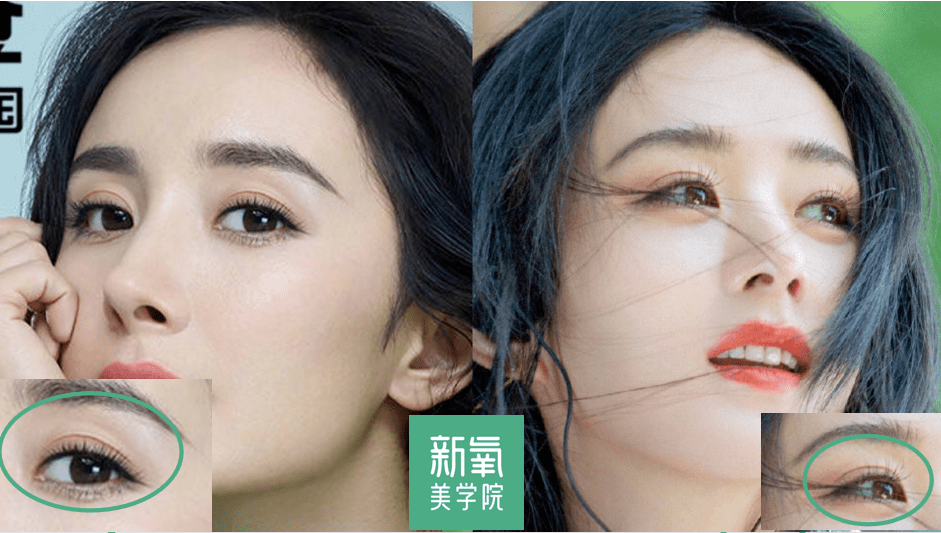 眉骨|给赵露思换了天使大宝贝的眉骨和眼眶骨，这张脸洋气指数飙升120%