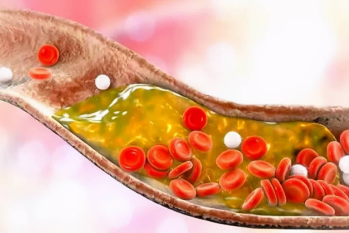 补充|昆明中研医院：甲减和很多疾病都是有关系的，下面让我们一起来了解下吧