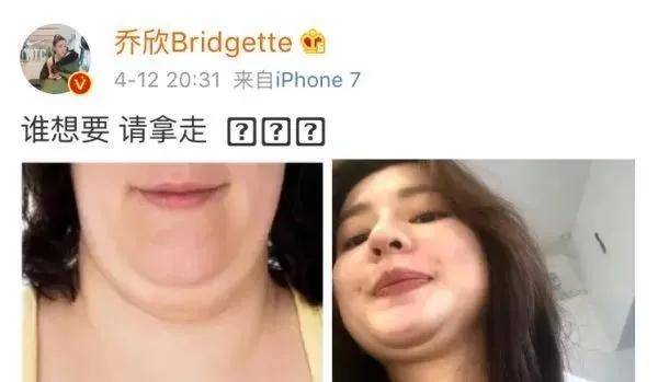 眉骨|给赵露思换了天使大宝贝的眉骨和眼眶骨，这张脸洋气指数飙升120%