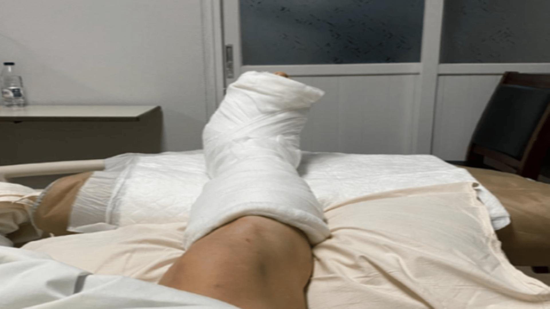 脚趾|断指移植黄金时间要知道，父亲接了个电话，女儿少了两根脚趾