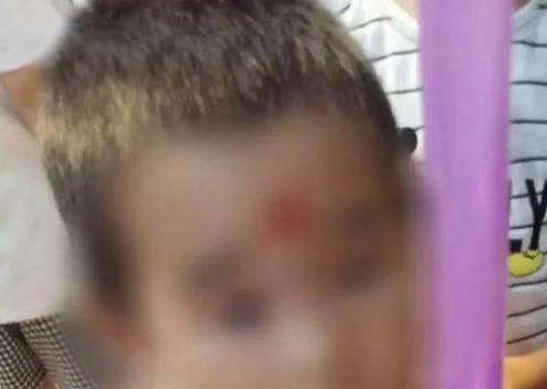 幼童|3岁幼童丧命幼儿园，园长说是中暑，却第一时间删除了监控