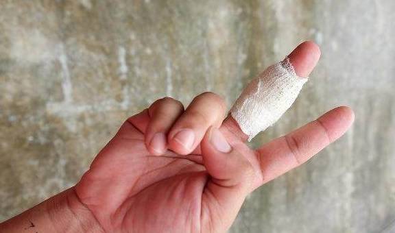 伤口|有没有糖尿病，看身体的3个“表现”，若有1个，可能需要查血糖了