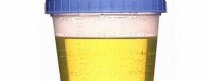 肾脏|身体出现8种症状别大意，可能是肾脏发出的报警信号