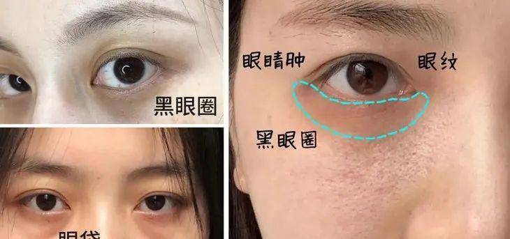 眼睛|眼部保养重在“润”！用它一喷好舒服，细纹慢慢膨了起来