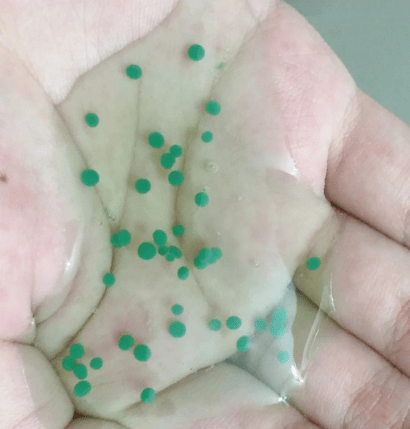 头皮|这3类洗发水列入“黑名单”，皮肤科主任都避开，新手妈妈还买？