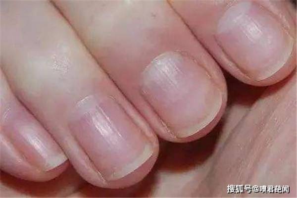 指甲怎么长出 8baf1a4819444ccbba919e1e4ce30544.jpeg