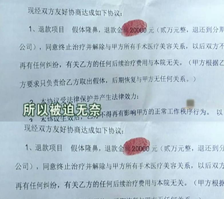 整形|女子整3次鼻子假体露出，医院：无法补救，女子：被威胁，很无奈