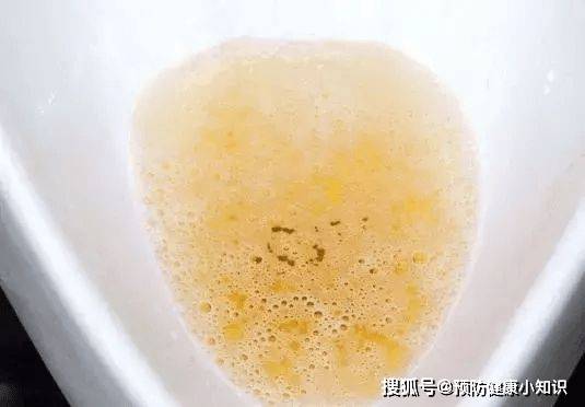 严重|小伙查出肝癌,医生:出现“2痛3臭”,快查查肝