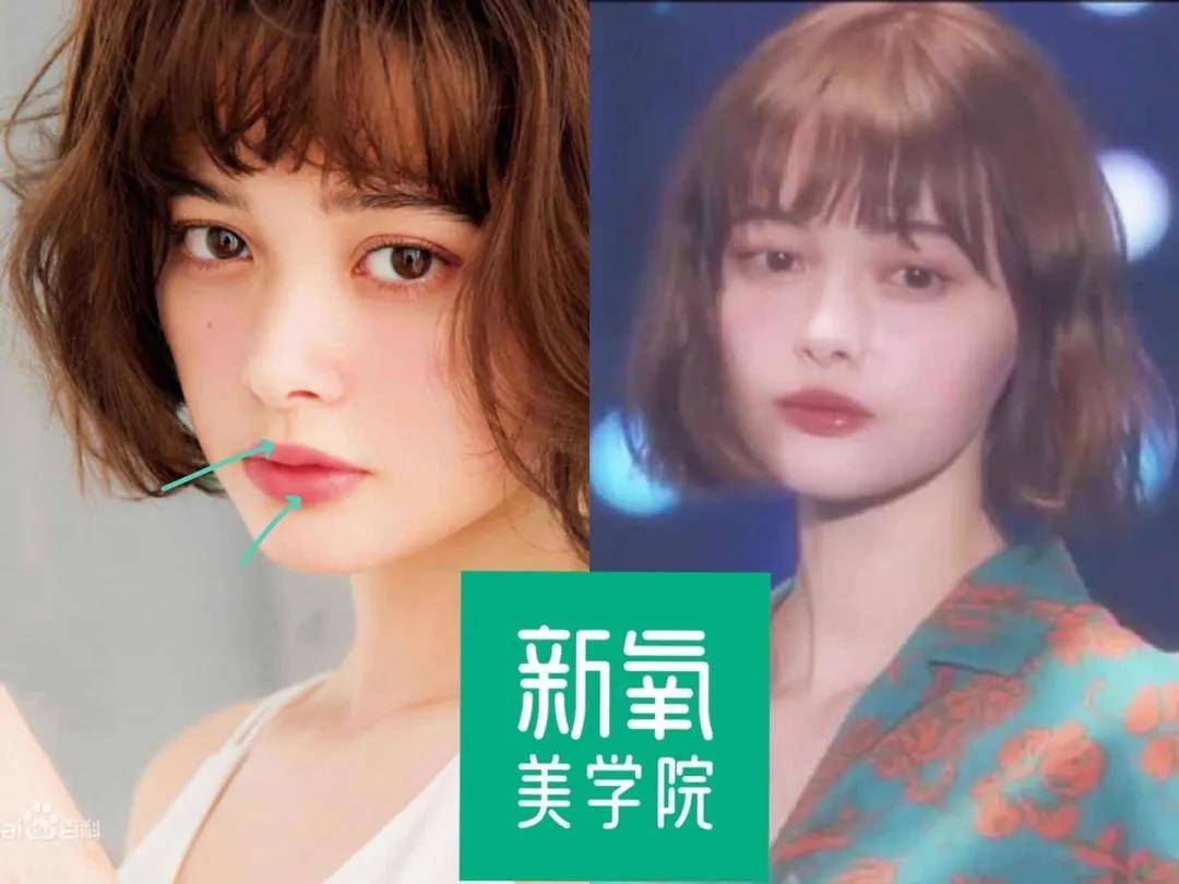 面部|混血赫本肿成辛芷蕾，她是花期最短的宅男女神？