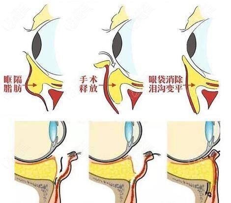 眼袋|关晓彤才24岁，黑眼圈就要把卧蚕吃掉了……