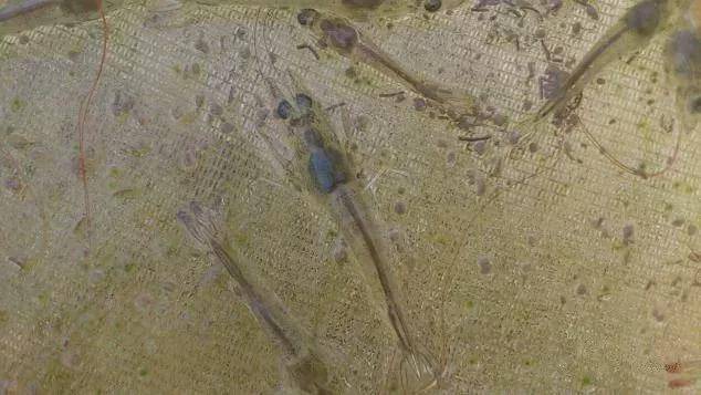 产品|为什么对虾肝脏容易发病?这些不明白你会后悔的!