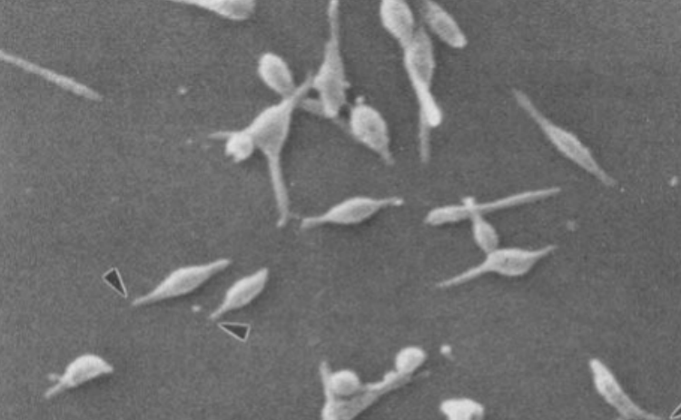 养殖|秋季养殖知识|为什么秋季猪容易发生支原体肺炎？