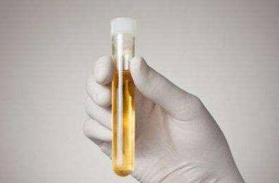 什么|做尿常规需要注意什么?大部分肾病患者都答不上来