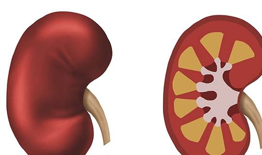 毒素|身体发出异味，要警惕，有可能是尿毒症来临，赶紧去检查