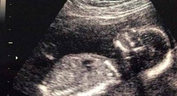 头胎|二胎又是男孩儿，家里人都是什么反应？就服那个顺着墙瘫下去的！