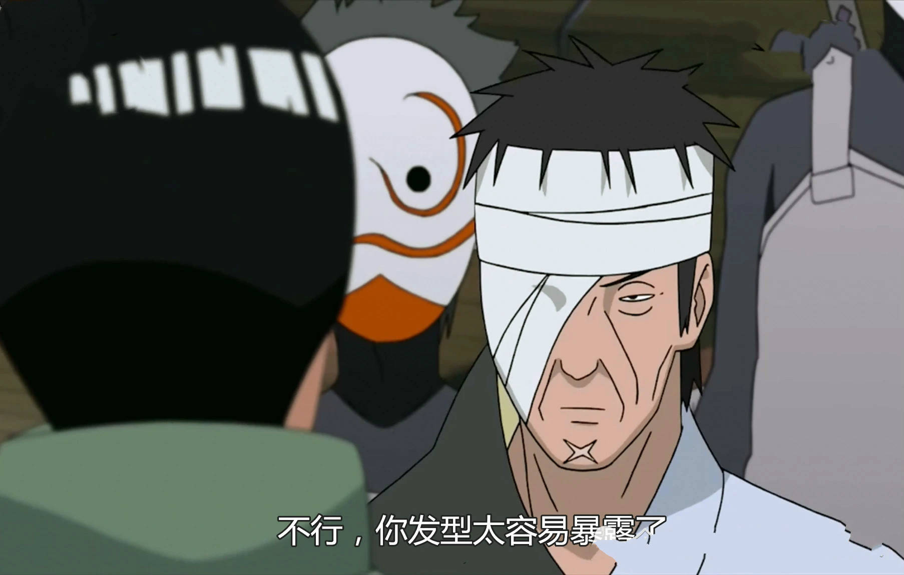 黑暗|火影忍者：卡卡西能进暗部，那为什么凯就不可以？