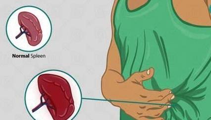 血液|体检出脾肿大,说明有肝硬化?慢性乙肝患者:欲知原因,请看此文