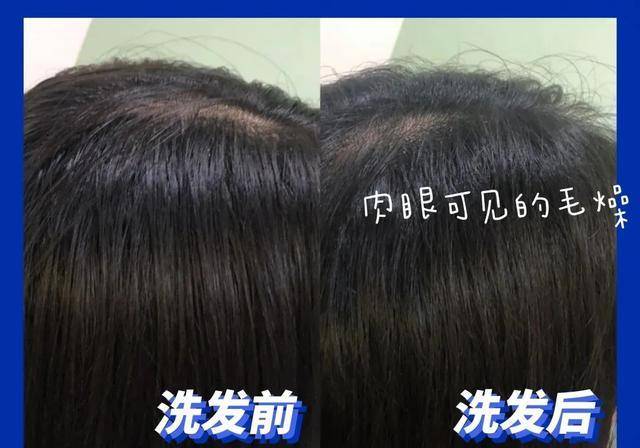 头皮|超难用的洗发水避雷，你中招了吗？