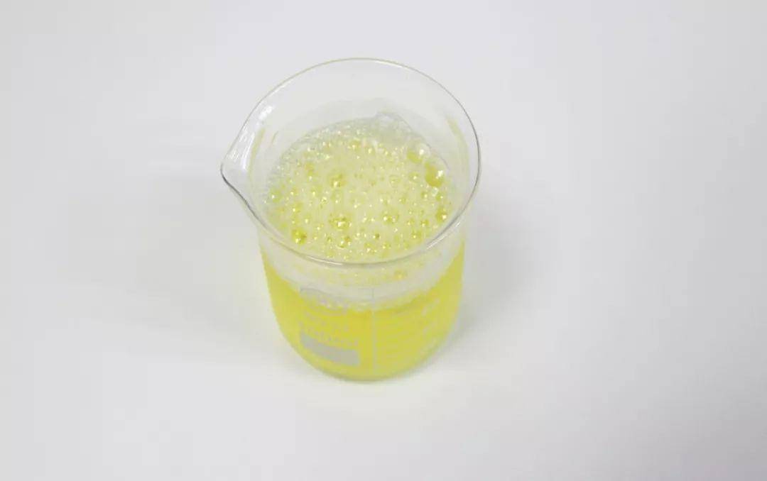 我国|肾病早期毫无感觉，发现已是肾衰竭？远离肾病，带您了解这些知识