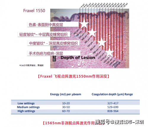 玛吉|热玛吉同门姐妹：飞梭镭射Fraxel美白、缩毛孔绝了！