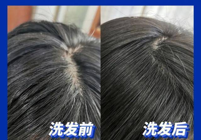 头皮|超难用的洗发水避雷,你中招了吗?