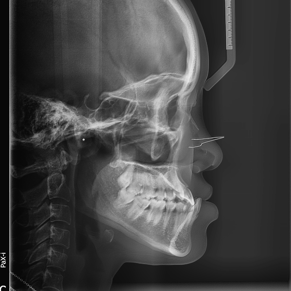 8471244a9f234944ada3d0ce376853a8.png