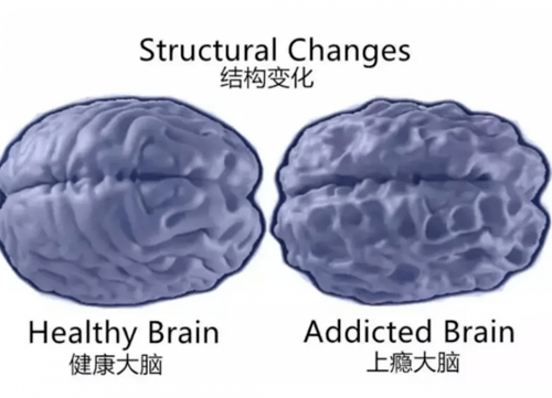 青少年|合肥天使儿童戒网瘾中心:别让游戏毁了孩子的一生