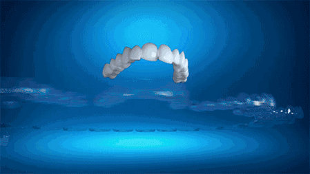 粘结|牙齿矫正科普：隐形矫正ｖｓ传统金属矫正