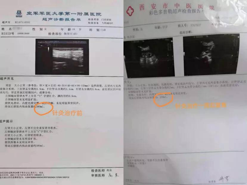 针灸|丨康复馆丨神经源性膀胱的危害不容小觑！