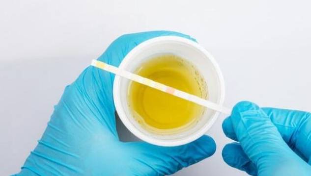 肾脏|肾病停药的标准是什么?稳住1点管好2方面,多数人可停药