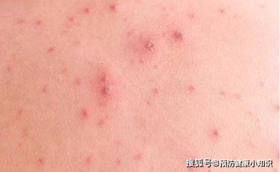 功能|身体4种变化，肝或已慢慢“硬如石块”，若你没有，偷着乐吧