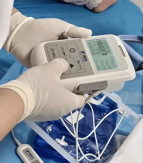 加速康复的福音镇痛泵