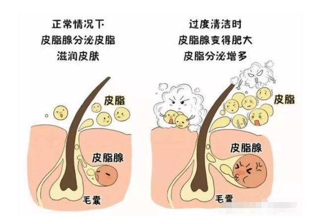 脸部|夏天总是满脸油光，佰花方控油收敛水让你夏天不再油到反光！