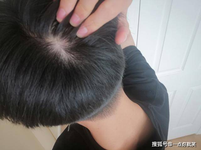 头发硬的人是什么命 头发硬的人命硬？揭开千年相术的现代生存法则