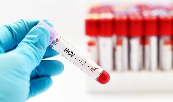 肝脏|乙肝身上出现红痣是怎么回事？这些知识，需要了解清楚