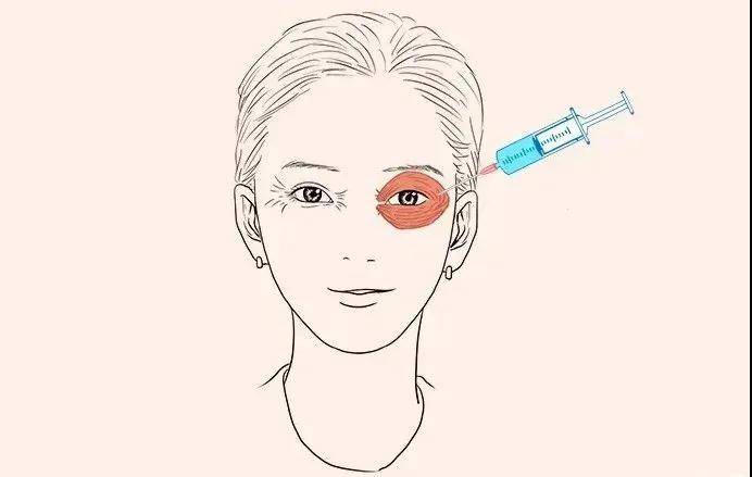 女孩子|常州曙光美容医院 女孩子如何保持“皮相美”？这些医美功不可没！