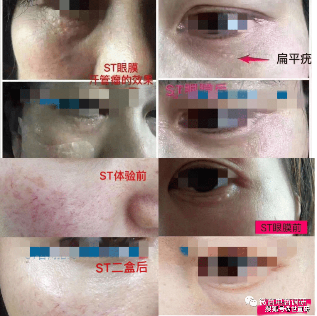曾被责令停产停业 宾奎国际系列产品到底有多神奇?(图7) 曾被责令停产停业 宾奎国际系列产品到底有多神奇?(图7)