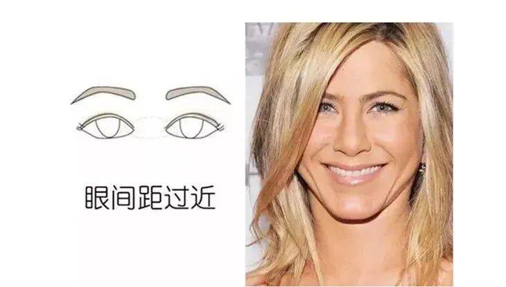 张力|五官C位可不能随便动,鼻综合也不是人人适合!