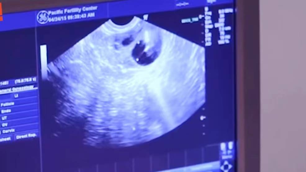 Doris|不想结婚，只想生孩子，你敢吗？看完她的故事，我服了