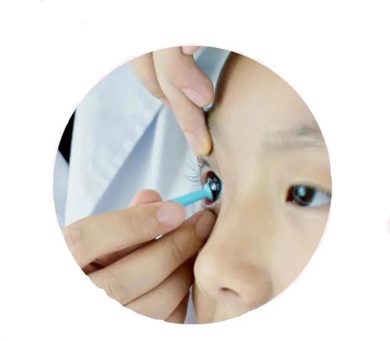 角膜塑形镜的吸棒双联盒每天用如何护理你知道吗