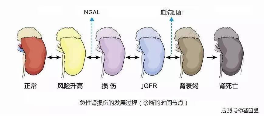 renal|健康科普：血液透析那些事儿