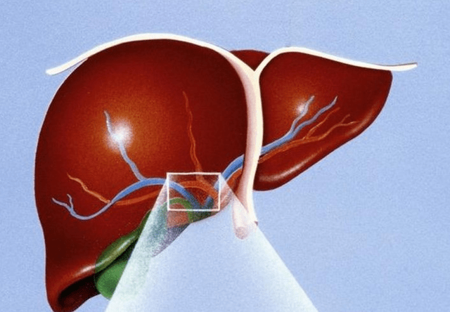 肝脏|男性“晨起”的3大行为,比喝酒还伤身,你中招了没有