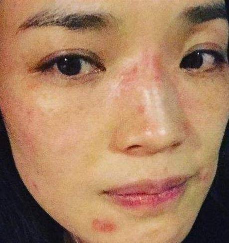 状态|女明星生图，杨幂、热巴细纹盖不住，杨颖长痘，而最吓人的是她？