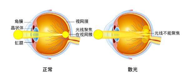 有哪些危害?_眼睛