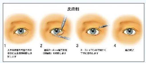 眼睛|魅惑狐系脸偏要做幼态眼睑下至？别再跟风微整啦，看看你是什么样的动物系长相