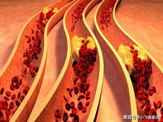 肾脏|肾衰竭会发生的“恶化”！带你了解一下，养肾是多么的重要